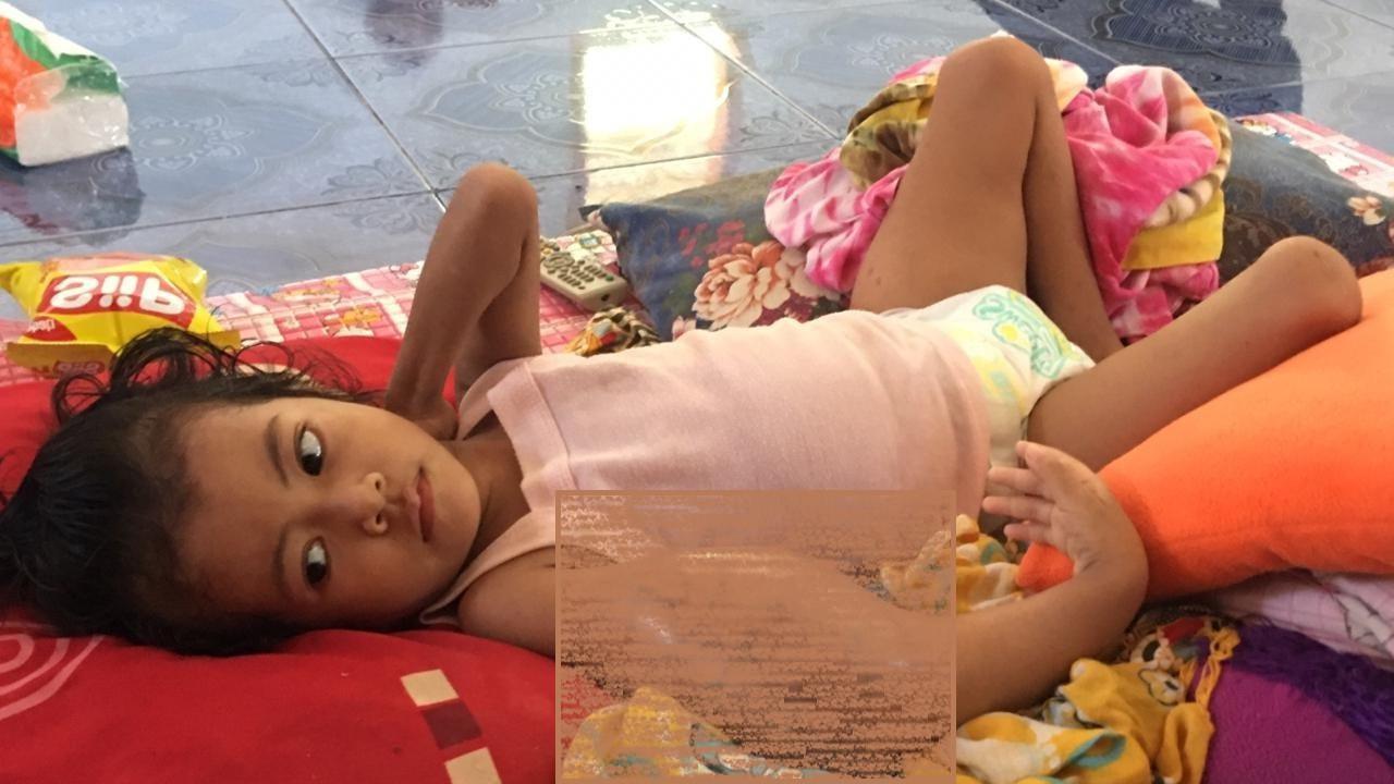 Bocah Penderita Tumor Ganas