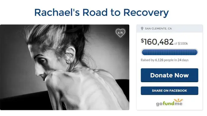 Ingin Sembuh dari Aneorexia, Rachael Farrokh Malah Dibully