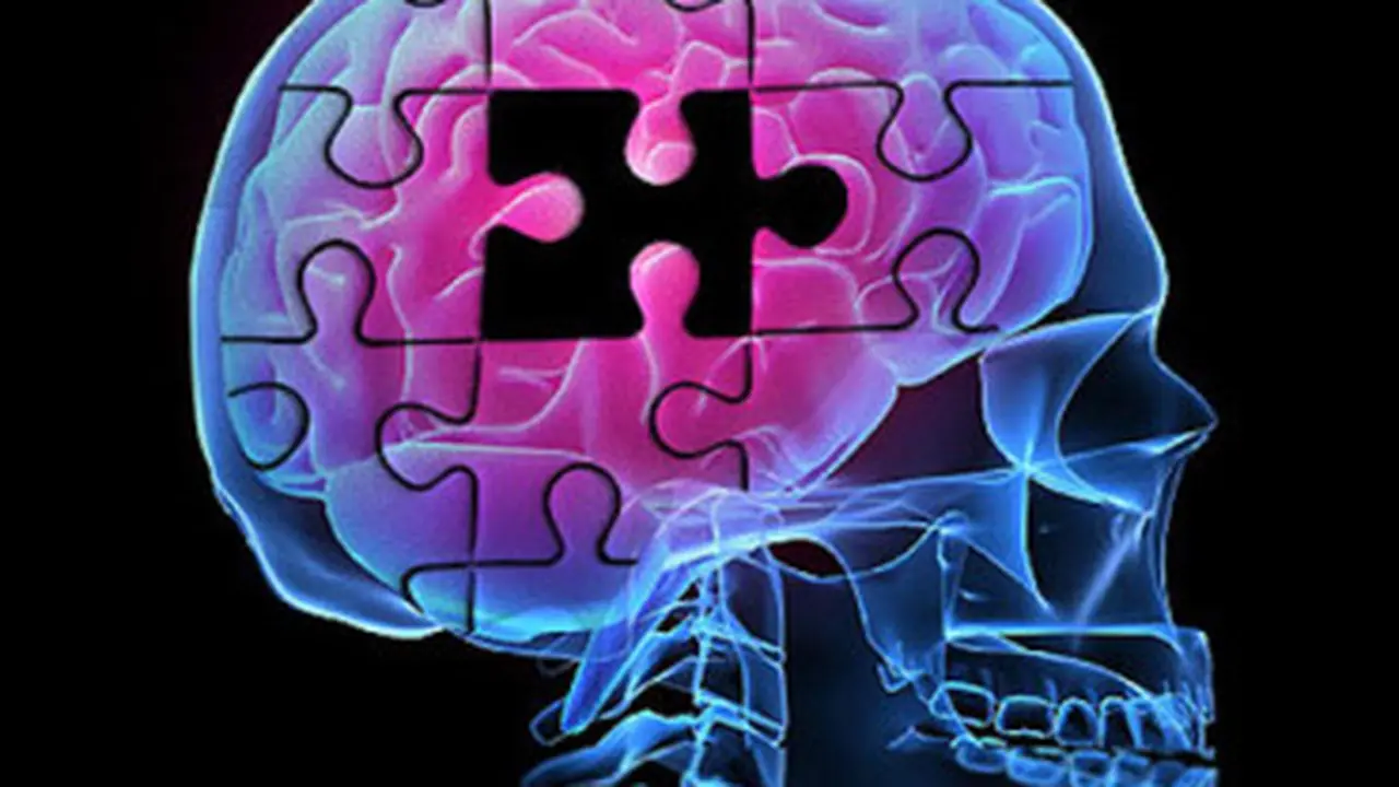 Alzheimer