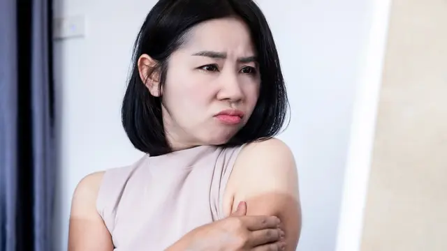 Kupas Tuntas Rahasia Meratakan Kulit Belang Pada Tubuh, Yuk Upgrade Penampilan Biar Semakin Pede