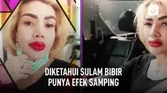Belum lama ini Barbie Kumalasari melakukan sulam bibir. Namun bibirnya nampak bengkak bahkan terlihat seperti jontor.