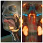 Saat periksa pasien, ilmuwan asal Belanda tak sengaja temukan organ baru di area hidung dan tenggorokan. Sumber: Brightside