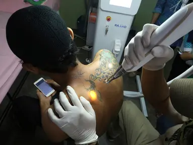 Petugas klinik menghapus tato di tubuh seorang pria bernama Taufiq Hidayat di Tangerang (9/8). Klinik tersebut menawarkan jasa hapus tato gratis dengan syarat pasien harus membaca dan belajar Alquran Surat Arrahman. (AP Photo/Achmad Ibrahim)