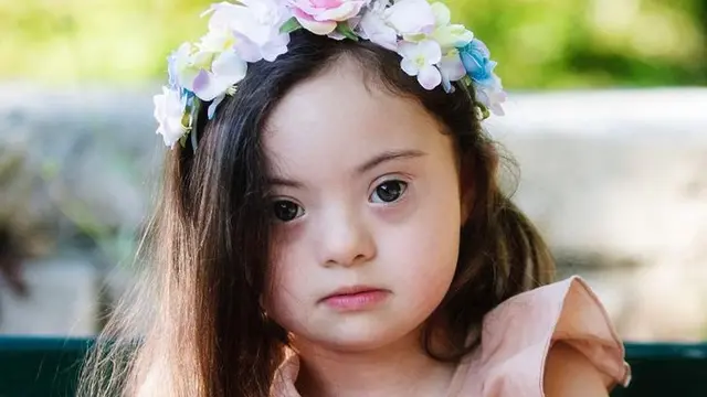 francesca model down syndrome berusia 4 tahun