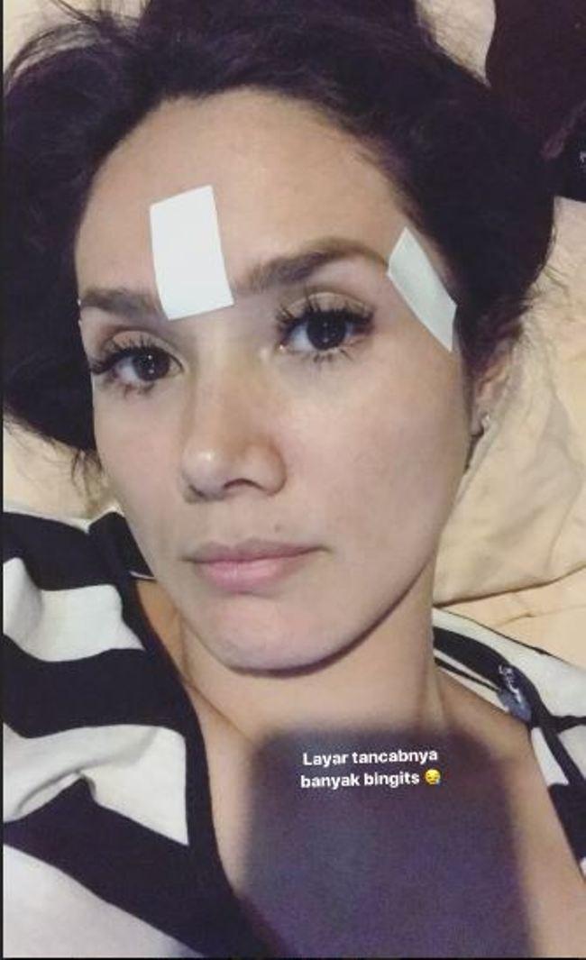 Pasang Koyo di Kepala, Bulu Mata Mulan Jameela Tetap Cetar - ShowBiz