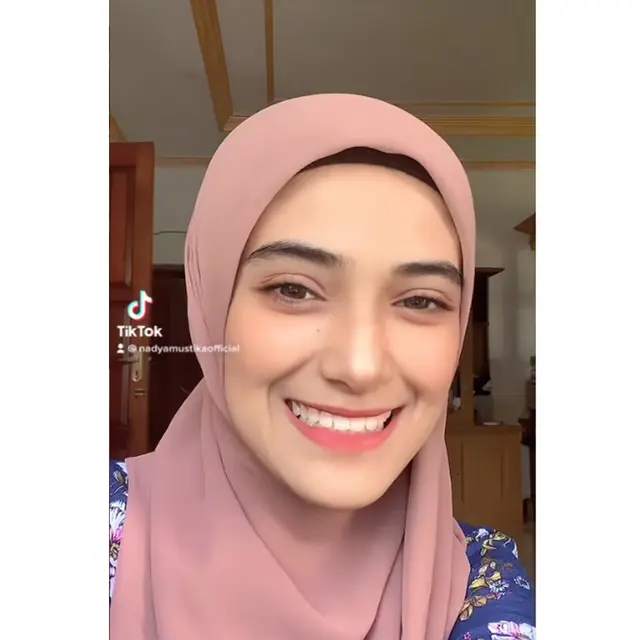Kerap Ditanya Netizen, Ini 6 Potret Nadya Mustika Pamer Senyum Kelihatan Gigi