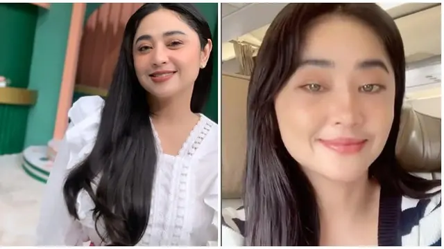 6 Potret Beda Penampilan Dewi Perssik Sebelum vs Setelah Operasi Transfer Lemak