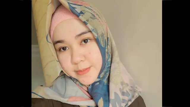 Dian Anggraeni Hartono, korban begal sadis yang mempertahankan tasnya hingga hidungnya nyaris hilang (Facebook/Dian Hartono)
