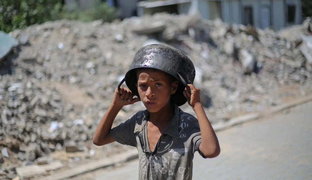 UNRWA menyebut bahwa salah satu kliniknya di Gaza mencatat peningkatan jumlah kasus malnutrisi sejak Maret 2025 lalu, ketika pengepungan total oleh Pemerintah Israel mulai diberlakukan. (Eyad BABA/AFP)