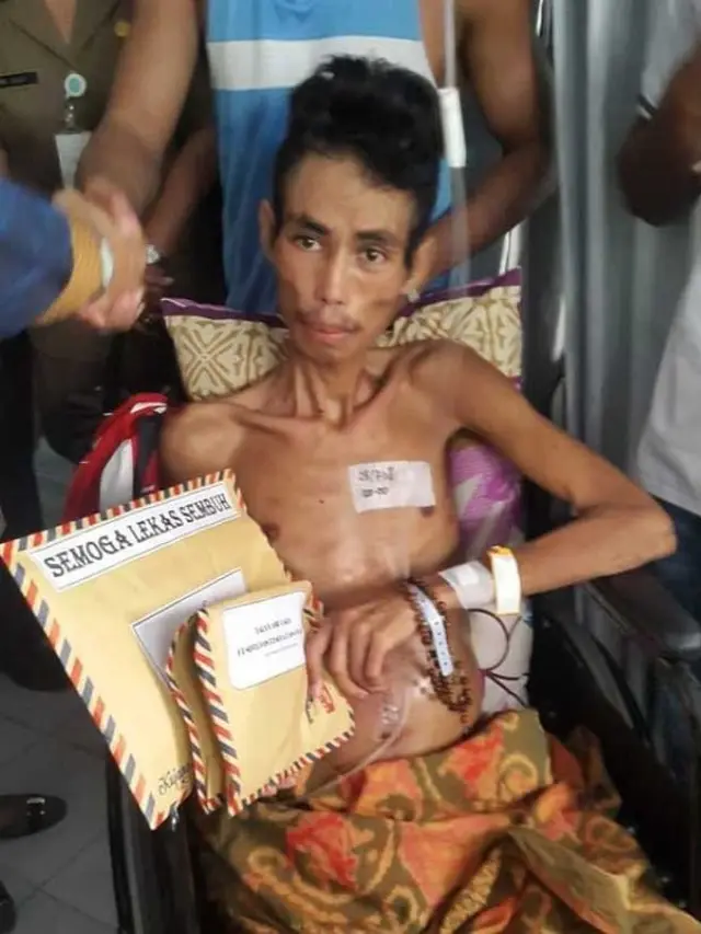 Valentinus Nahak berjuang melawan kanker (Hak Cipta: Kemenpora/frs)