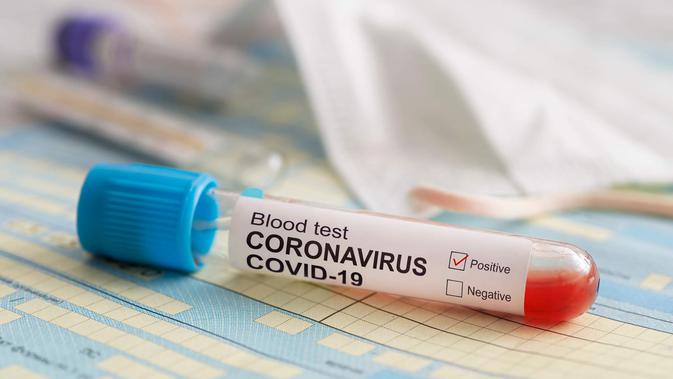 ilustrasi virus corona/copyright by diy13 (Shutterstock)