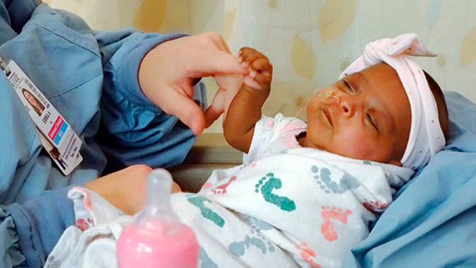 Foto pada Maret 2019 memperlihatkan seorang bayi yang dipanggil dengan nama Saybie. Saybie dilahirkan dengan operasi caesar darurat setelah sang ibu didiagnosis menderita pre-eklampsia, komplikasi kehamilan yang dapat berakibat fatal bagi ibu dan bayi. (Sharp HealthCare via AP)