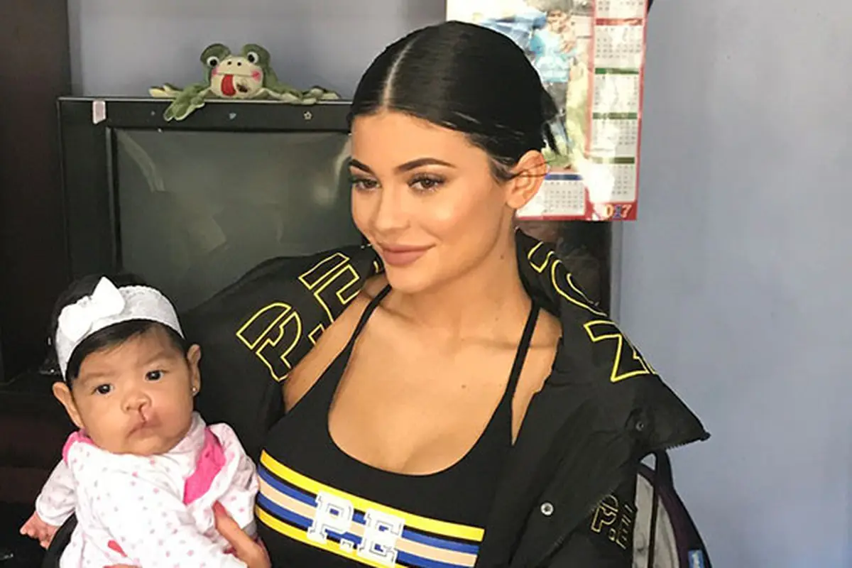Kylie Jenner membantu anak-anak dengan bibir sumbing jalani operasi lewat keuntungan penjualan lip kit. (Foto: www.smiletrain.org)