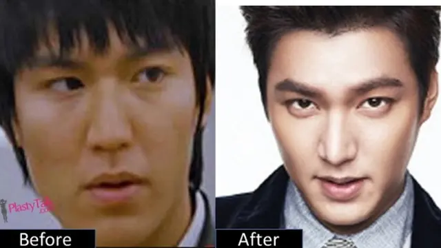 Lee Min Ho