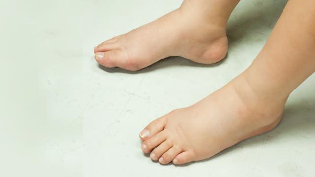 Badan panas telapak tangan dan kaki dingin gejala apa pada anak