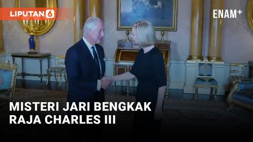 VIDEO: Jari Tangan Raja Charles III Bengkak, Sakit?