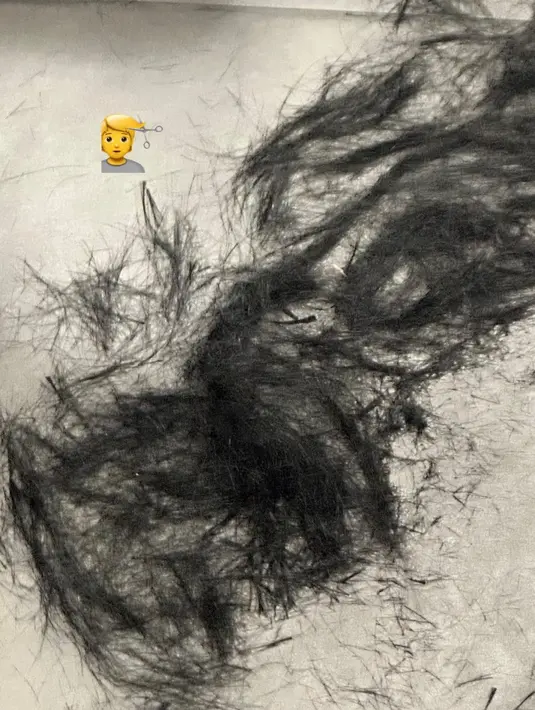 Rambut ini membuat para penggemar dan media berspekulasi bahwa ia telah mencukur rambutnya sebagai persiapan untuk wajib militernya yang akan datang. Sampai saat ini, tanggal keberangkatannya belum diumumkan. (Foto: Weverse Live via Allkpop)