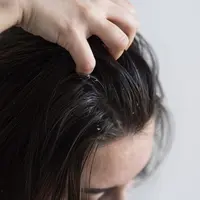Ilustrasi rambut berketombe (copyright Freepik)