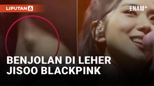 VIDEO: Ada Benjolan di Leher Jisoo Blackpink, Fans Khawatirkan Kesehatannya
