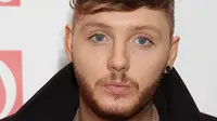 Berkelahi, James Arthur bangga Ada Luka di Wajah 