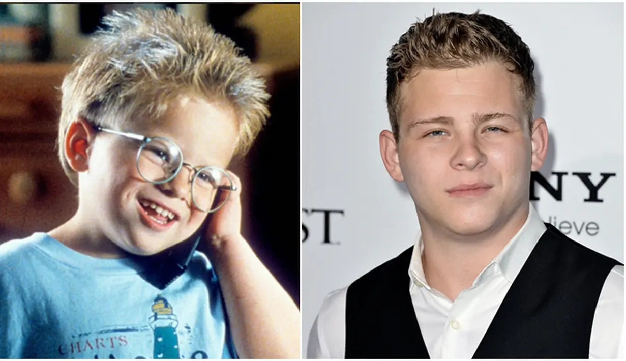Jonathan Lipnicki. Lahir pada tahun 1990 dan menjadi bintang film ‘Stuart Little’ sebagai George Little pada tahun 1999. Ia telah bekerja dengan organisasi seperti Yayasan Kanker Payudara. (via instagram – AFP/Bintang.com)
