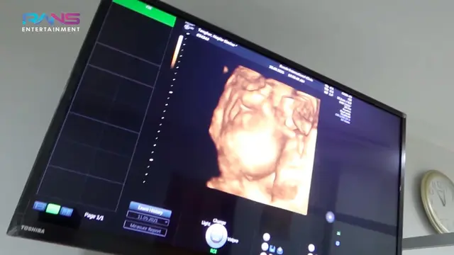 Momen Nagita Slavina Periksa ke Dokter Kandungan, Diprediksi Hamil Anak Laki-laki. (Sumber: Youtube/Rans Entertaiment)