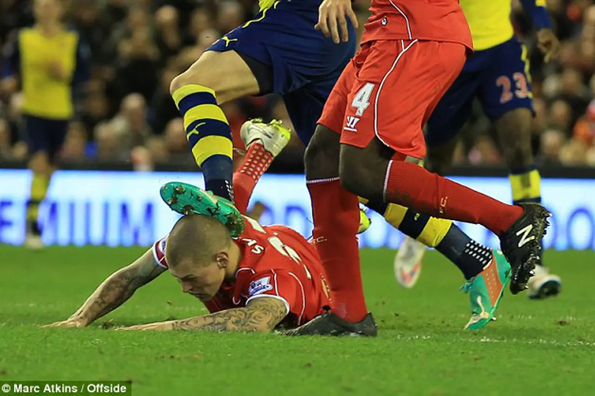 Bek Liverpool Martin Skrtel