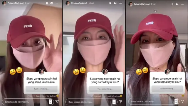 Clairine Clay Ungkap Masalah Noda yang Dialami