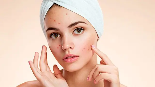 Ini 5 Masalah Tidak Menghapus Make Up Sebelum Tidur