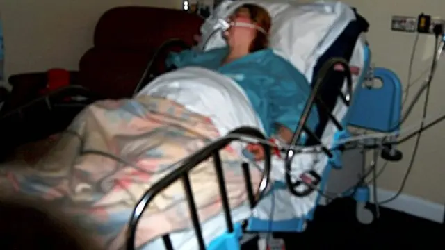 [Bintang] Beth Hampir Meninggal