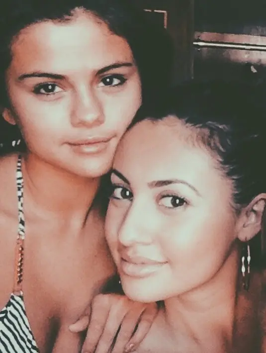 Lewat Instagram, Francia Raisa pun mengunggah kata-kata manis untuk Selena Gomez dan dirinya usai operasi. (instagram/franciaraisa)