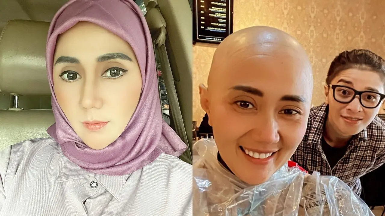 Aida Saskia Jalani Kemoterapi