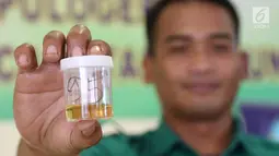 Sopir bus Antar Kota Antar Provinsi (AKAP) memperlihatkan sampel urine saat tes kesehatan di Terminal Pulo Gebang, Jakarta, Kamis (22/6). Tes urine untuk memastikan sopir dalam kondisi sehat dan tidak mengonsumsi narkoba (Liputan6.com/Immanuel Antonius)