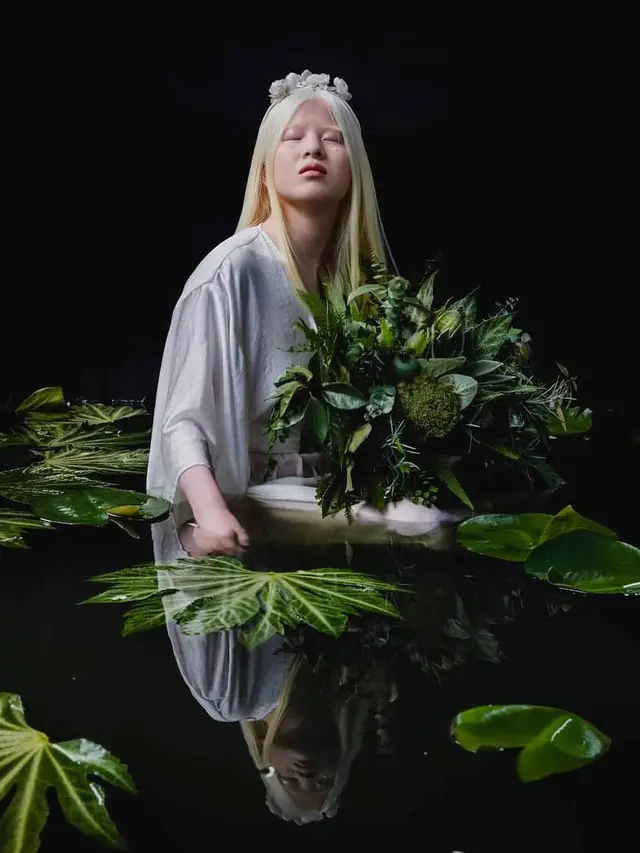 Dibuang ke Panti Asuhan Karena Albino, Ini 6 Potret Xueli Kini Sukses Jadi Model. (Sumber: Instagram/xueli_a)