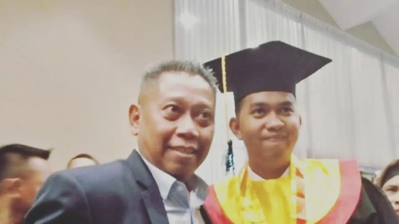 Tukul Arwana Alami Pendarahan Otak Bukan Karena Vaksin COVID-19