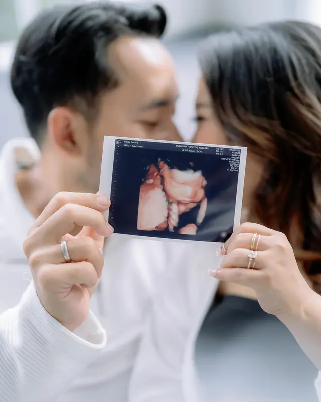 6 Potret maternity shoot Kiky Saputri bernuansa monokrom, pose kocak adu perut buncit dengan suami