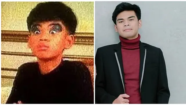 6 Potret Dulu Vs Kini Artis Cilik di Sitkom Populer, Bikin pangling