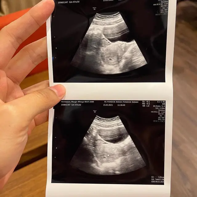 Umumkan Kehamilan, Ini 7 Potret Mesra Ali Syakieb dan Margin Wieheerm Usai Menikah