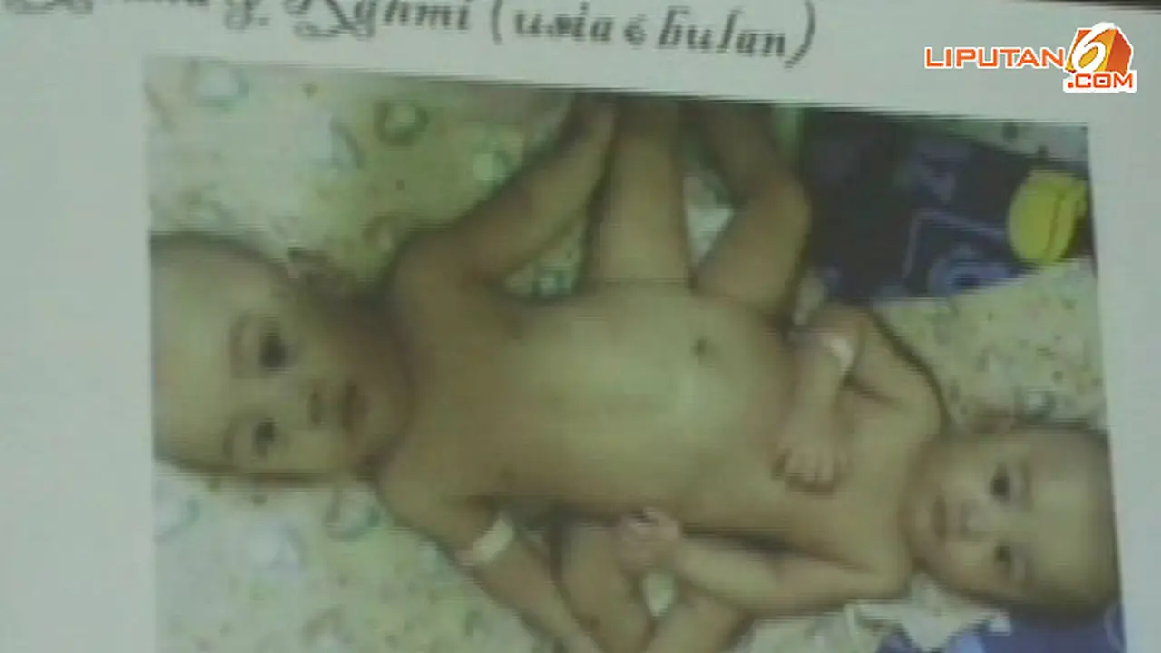 bayi-kembar-l130707a.jpg