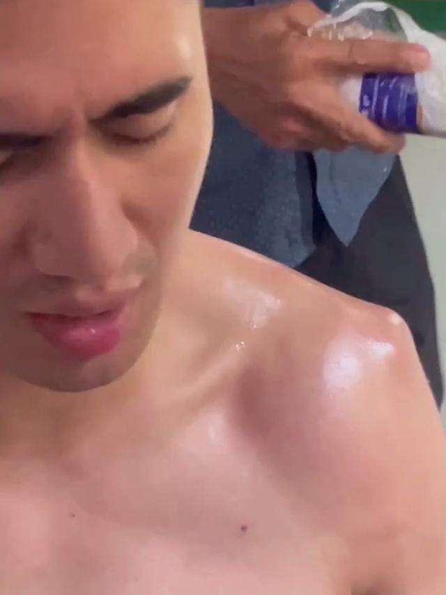 6 Potret Verrell Bramasta Berobat Usai 'Bahu Geser', Menahan Sakit Demi Sembuh