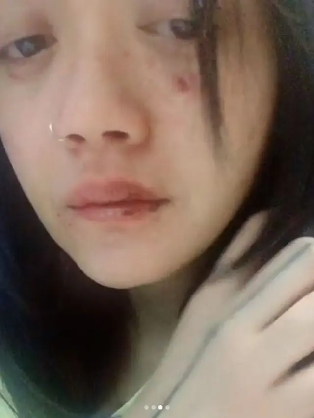 [Bintang] Dylan Sada, Model Cantik Asal Indonesia yang Merintis Karier di New York Alami Kekerasan