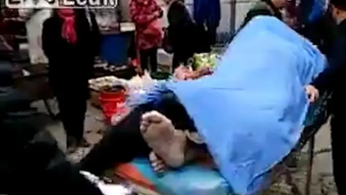 Tewas Saat Berhubungan Seks, Tubuh Pasangan Ini Masih 'Menyatu'