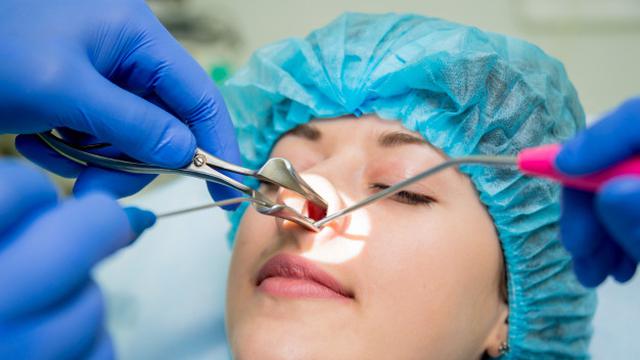 Apa Itu Sinusitis? Kenali Gejala, Penyebab, dan Cara Mengatasinya