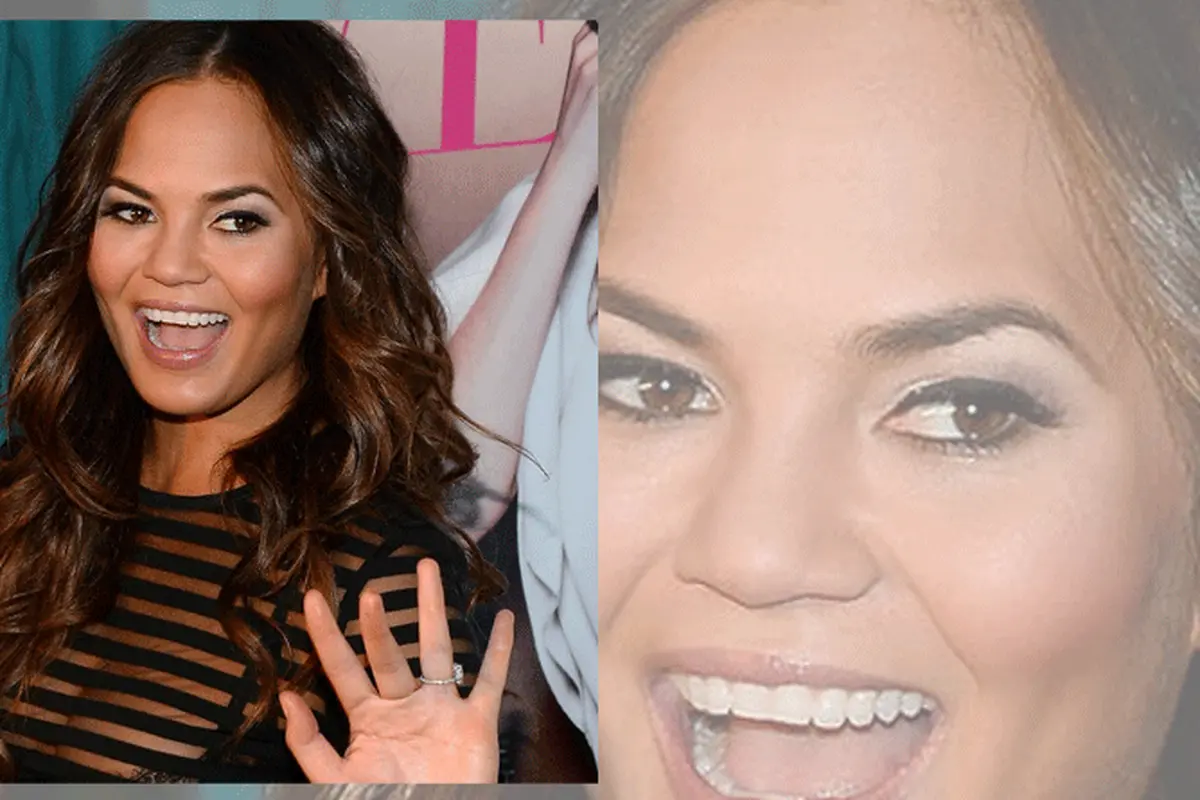 Chrissy Teigen