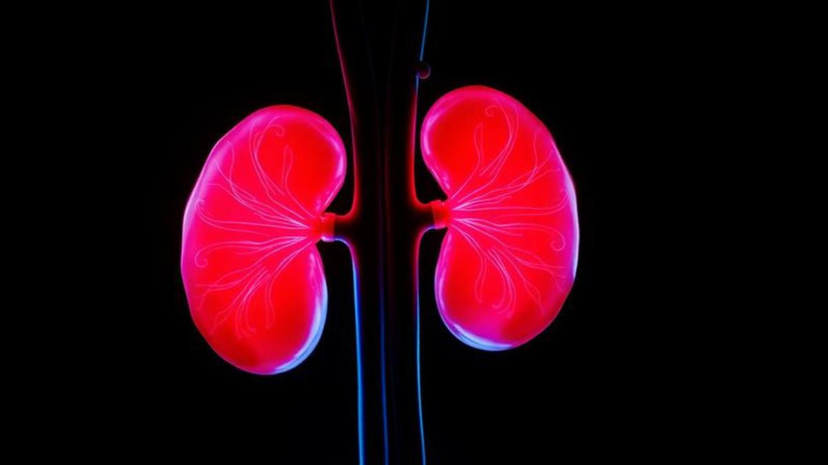 Kanker Ginjal Bisa Terjadi pada Orang yang Menerapkan Gaya Hidup Sehat, Ini Faktor Penyebabnya