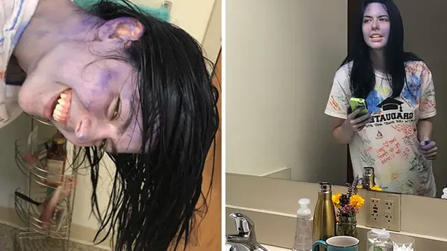 8 Potret Orang Gagal Semir Rambut, Ada yang Sampai Bengkak