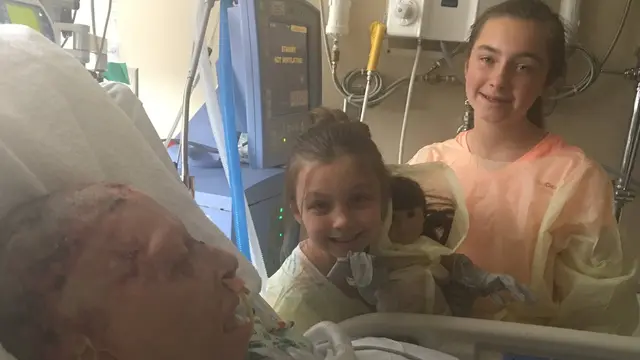 [Bintang] Karena Sang Mantan Pacar, Perempuan Ini Harus Menjalani 56 Kali Operasi