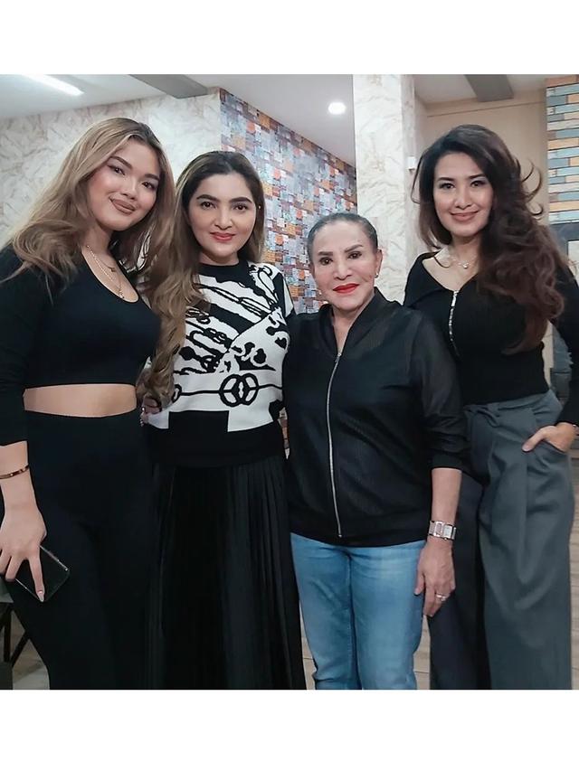 6 Potret Mpok Atiek yang Idap Polip di Ususnya, Akui Takut Ramalan Roy Kiyoshi