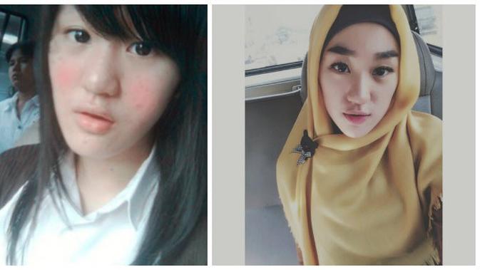 Drastis, Ini Penampilan Larissa Chou Sebelum dan Sesudah ...