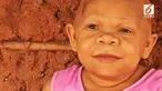 Kondisi ini berawal ketika keluarga mengabaikan gejala dari kelainan medis yang mulai dialami Maria di usia 9 bulan. Alhasil, wanita berusia 37 tahun ini terperangkap dalam tubuh bayi.